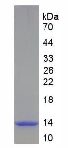 Human TFF1 / pS2 Protein (Recombinant His-GST)