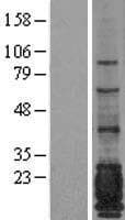 Human EMA / MUC1 Protein (Over-Expression Lysate Myc-DDK (Flag))