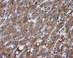 GBE1 Antibody (clone OTI3B4)