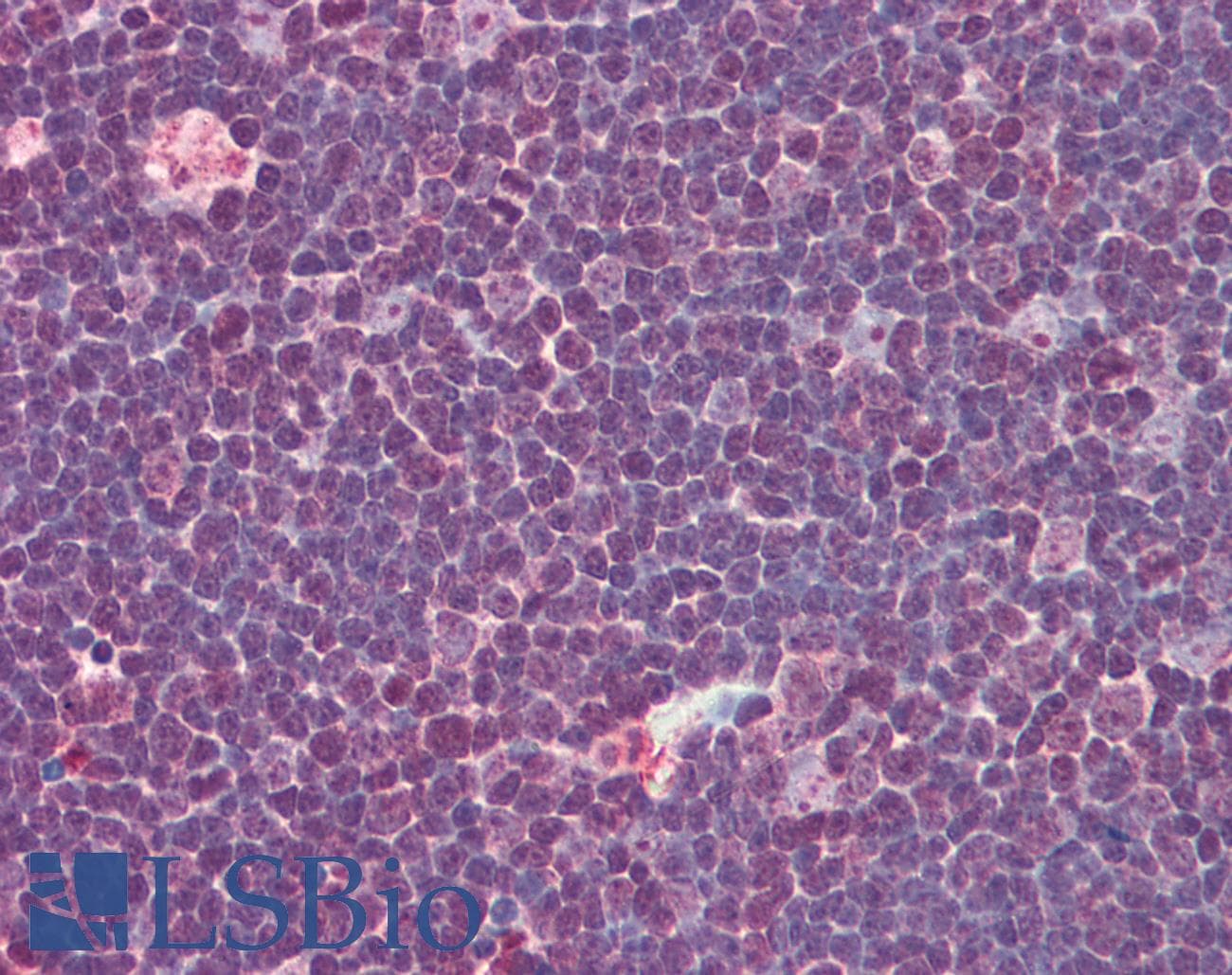 IHC-plus™ IL31 Antibody