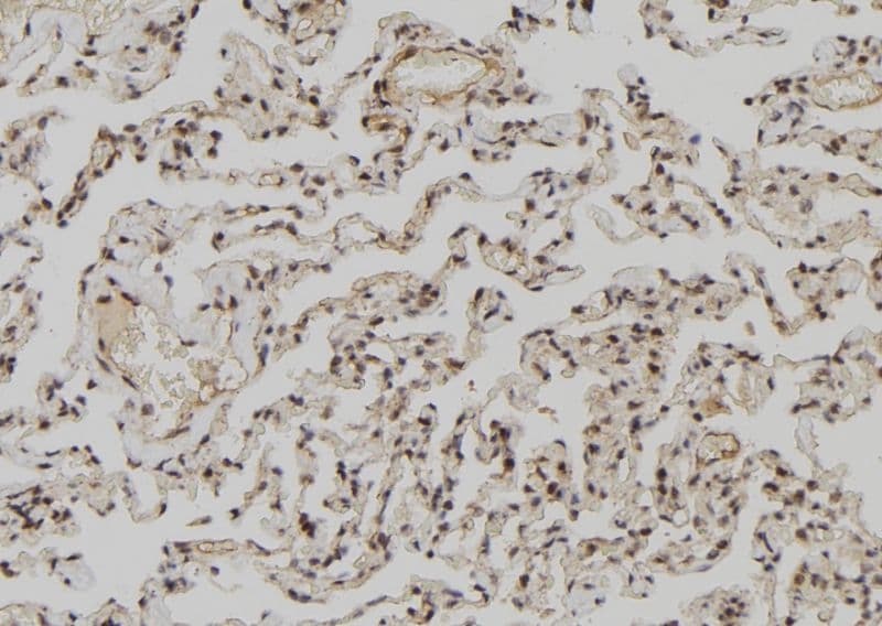 KIAA0191 / ZCCHC11 Antibody