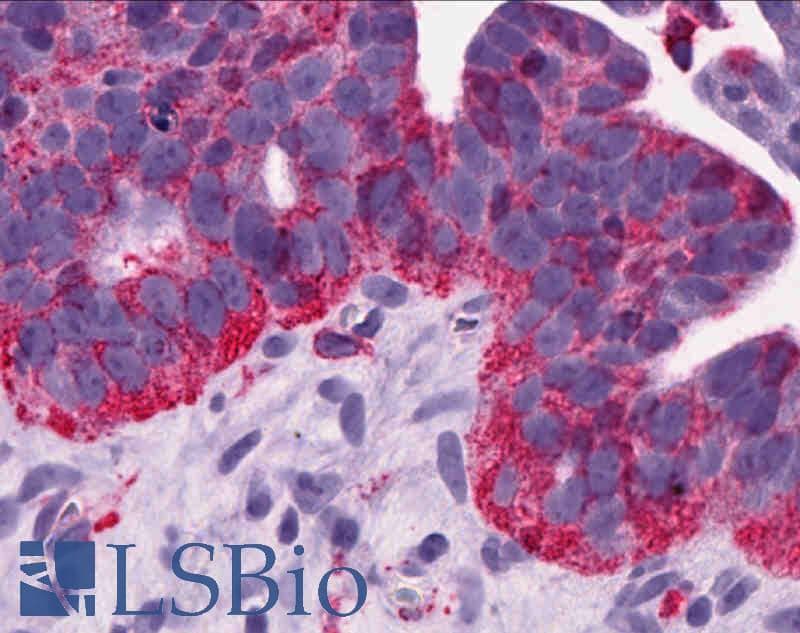 IHC-plus™ Polyclonal Rabbit anti-Human MCHR1 Antibody (N-Terminus, IHC)