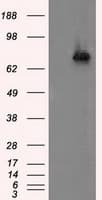 ACSBG1 / hsBG Antibody (clone OTI2B6)