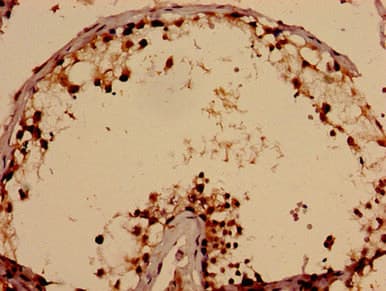 Polyclonal Rabbit anti-Human TBC1D31 / WDR67 Antibody (IHC)