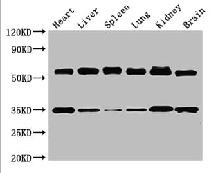 GBA / Glucosidase Beta Acid Antibody