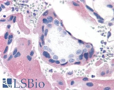 PathPlus™ BRS3 Antibody (C-Terminus)