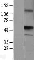 Human UST Protein (Over-Expression Lysate Myc-DDK (Flag))