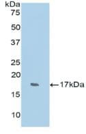 RNASE7 Antibody (aa31-155)