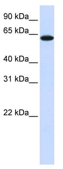 PathPlus™ TYRP1 / gp75 Antibody (aa396-445)