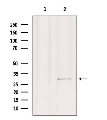 SIP1 Antibody