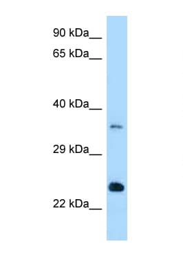 Polyclonal Rabbit anti-Mouse RAB13 Antibody (aa91-140, WB)