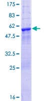 Human LRRK1 Protein (Recombinant GST)