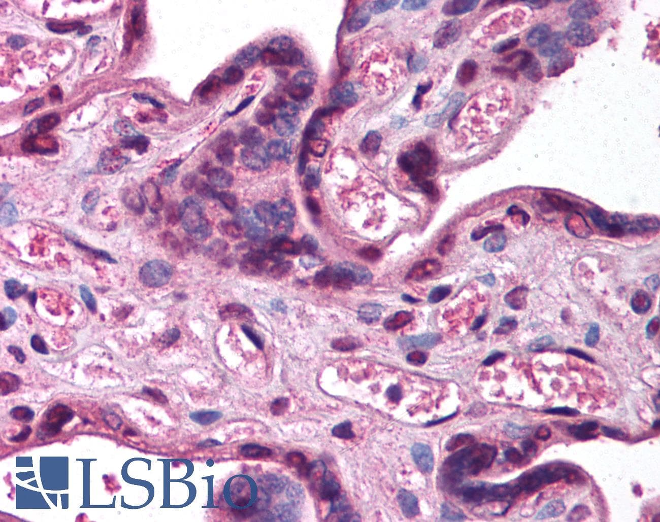 Polyclonal Rabbit anti-Human KCNK5 / TASK2 Antibody (aa421-470, IHC, IF, WB)