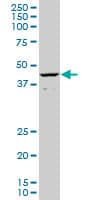 ALX1 Antibody (clone 2A10)
