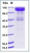 Human IL6R / IL6 Receptor Protein (Recombinant Human IgG Fc, C-terminus)