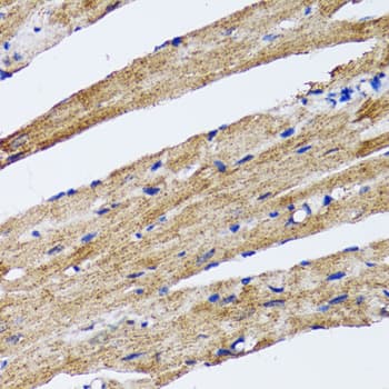 Polyclonal Rabbit anti-Human MAP1LC3B / LC3B Antibody (IHC, WB)