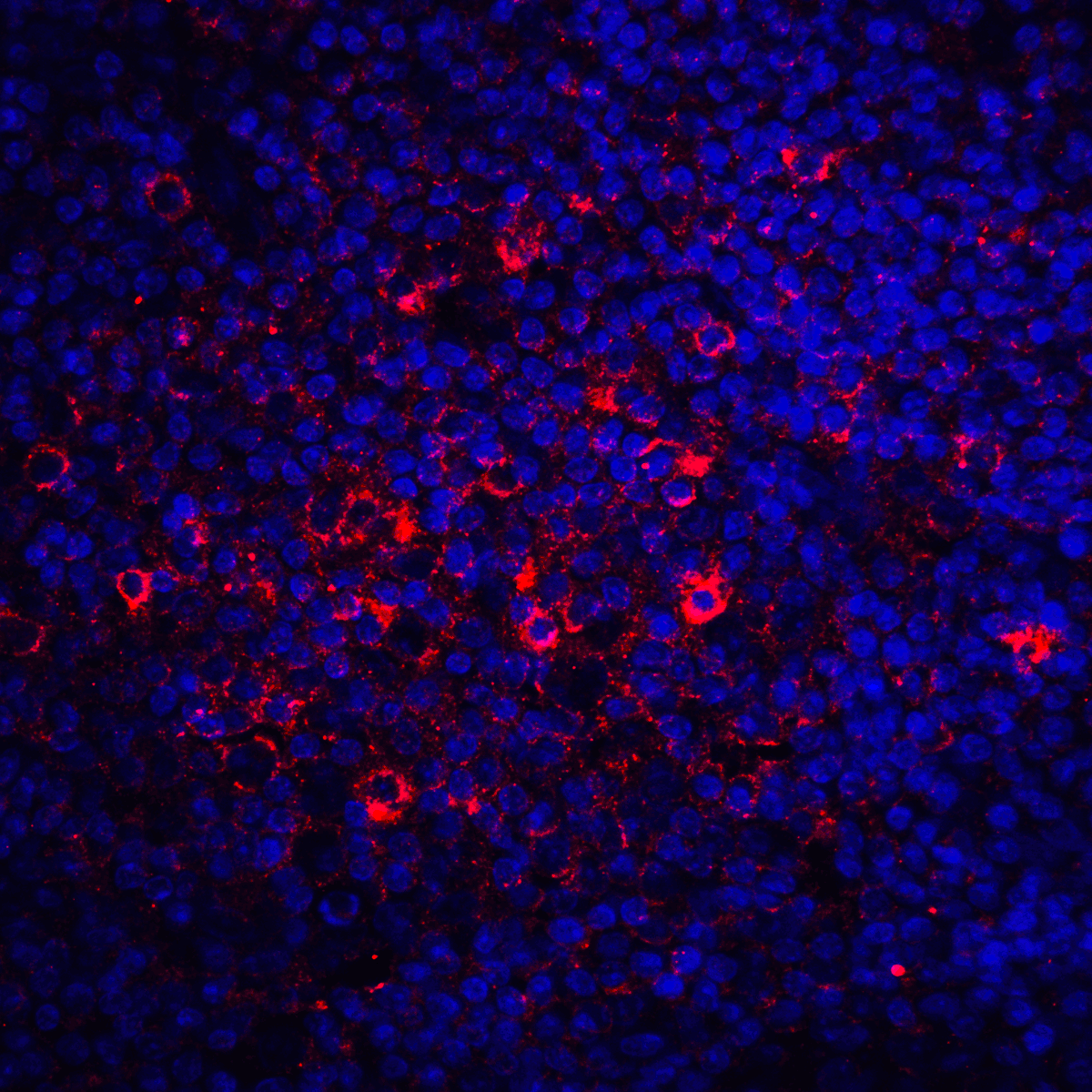 CTLA4 / CD152 Antibody (clone 2G10)