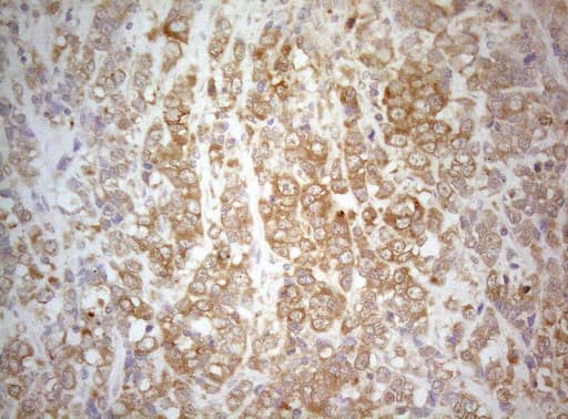 TWF1 / PTK9 Antibody (aa140-384, clone OTI5C12)
