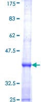 Human DOCK5 Protein (Recombinant GST, N-terminus)