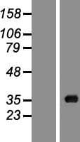 ACOT8 Protein (Over-Expression Lysate Myc-DDK (Flag))