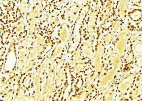CSNK1E / CK1 Epsilon Antibody