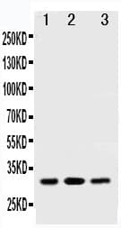 Polyclonal Rabbit anti-Human SDHB Antibody (aa42-59, IHC, WB)