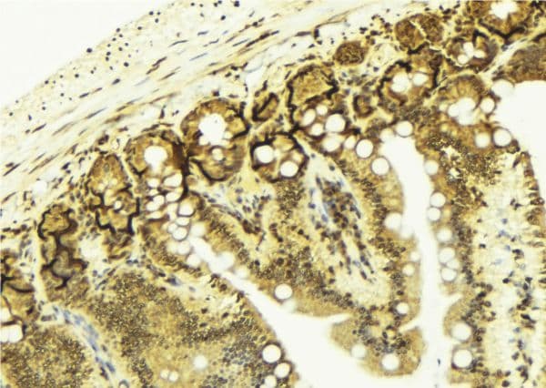 LGALS3 / Galectin 3 Antibody