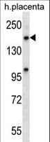 XPO5 / Exportin 5 Antibody (aa1123-1152)