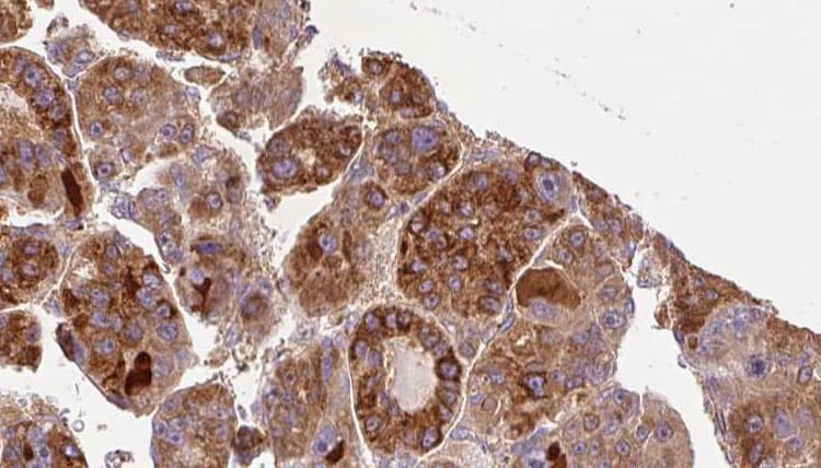 Polyclonal Rabbit anti-Human GNA11 Antibody (IHC, WB)