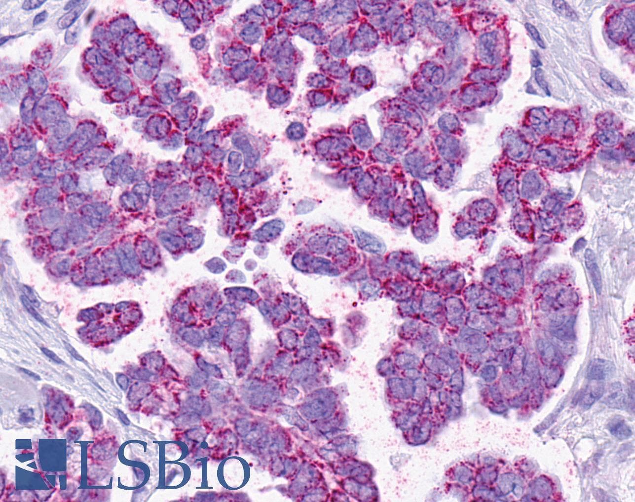 IHC-plus™ Polyclonal Rabbit anti-Human SMO / Smoothened Antibody (1st Extracellular Domain, IHC, IF)