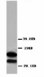 MBP / Myelin Basic Protein Antibody (aa182-197)