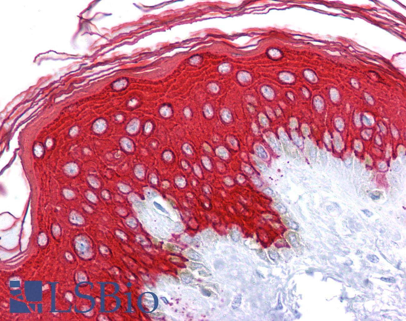 PathPlus™ Monoclonal Mouse anti-Human KRT10 / CK10 / Cytokeratin 10 Antibody (clone DE-K10, IHC, WB)