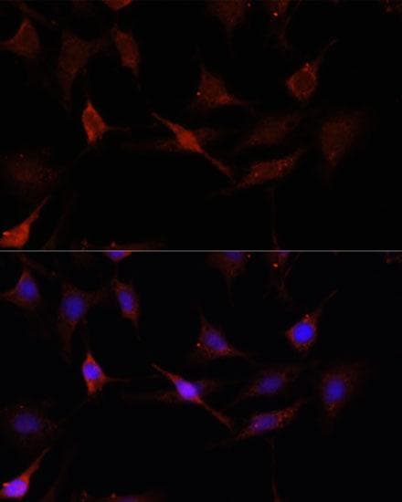 GPER1 / GPR30 Antibody