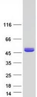 Human ASPA Protein (Recombinant Myc-DDK (Flag))