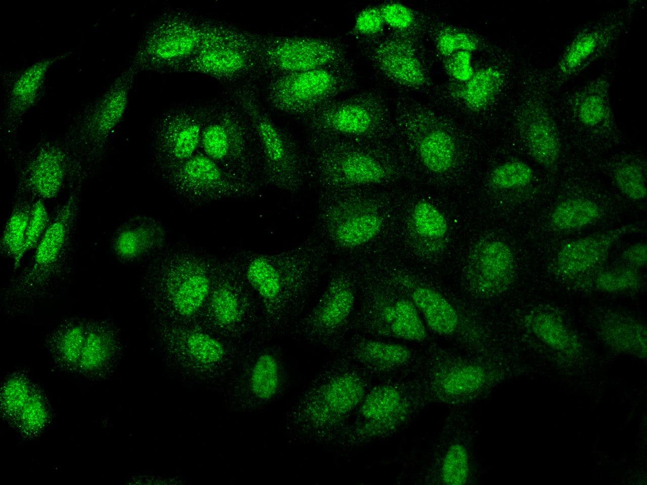MN1 Antibody