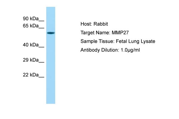 MMP27 Antibody (aa191-240)