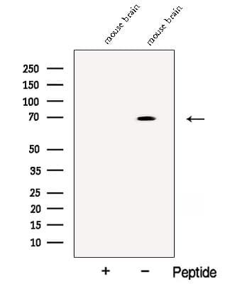 Polyclonal Rabbit anti-Human ACCN1 / ASIC2 Antibody (WB)