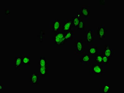 MAPK7 / ERK5 Antibody (aa1-310)
