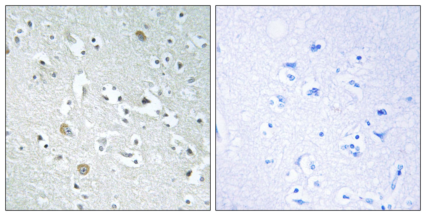 Polyclonal Rabbit anti-Human PSPLA1 / Phospholipase A1 Antibody (aa381-430, IHC)
