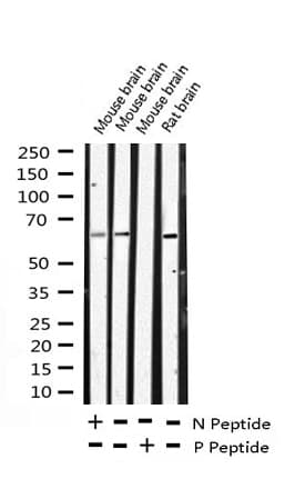 ELK1 Antibody (phospho-Ser383)