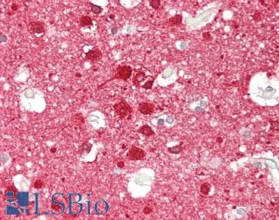 IHC-plus™ Polyclonal Rabbit anti-Human PPP3R1 / Calcineurin B Antibody (IHC, WB)
