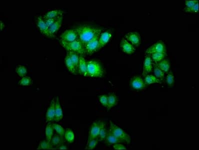 WASF2 / SCAR2 Antibody