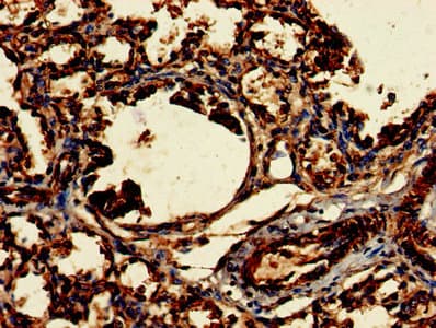 CLRN2 Antibody