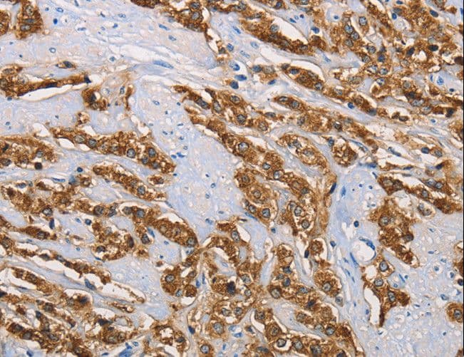 KLK1 / Kallikrein 1 Antibody