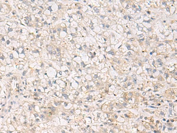 Polyclonal Rabbit anti-Human TNNT1 / TNT Antibody (IHC, WB)
