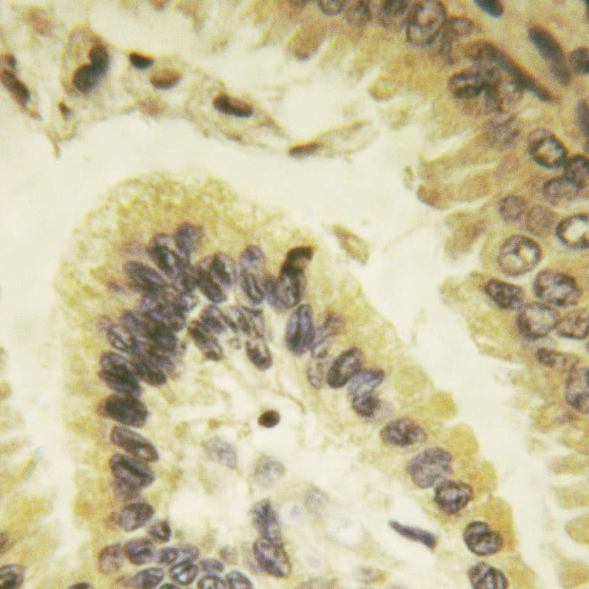 Polyclonal Rabbit anti-Human BCL2L1 / BCL-XL Antibody (phospho-Thr47, IHC, IF, WB)