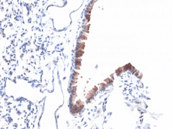 Monoclonal Mouse anti-Human MSLN / Mesothelin Antibody (clone MSLN/2131, IHC)