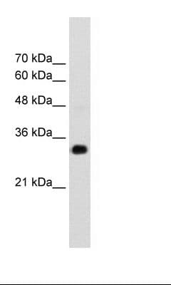 RNF121 Antibody (aa101-150)