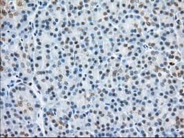 H6PD / G6PDH Antibody (clone OTI2A7)