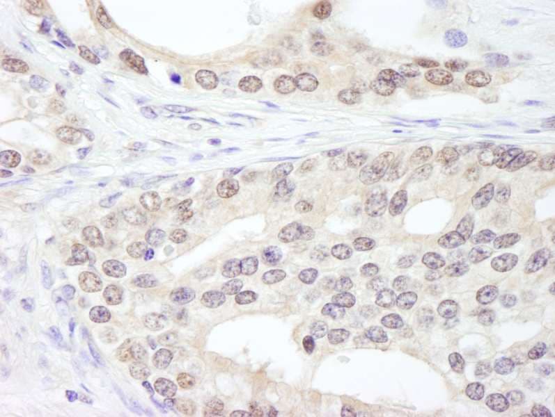 SF3A1 / SF3A120 Antibody (aa500-550)